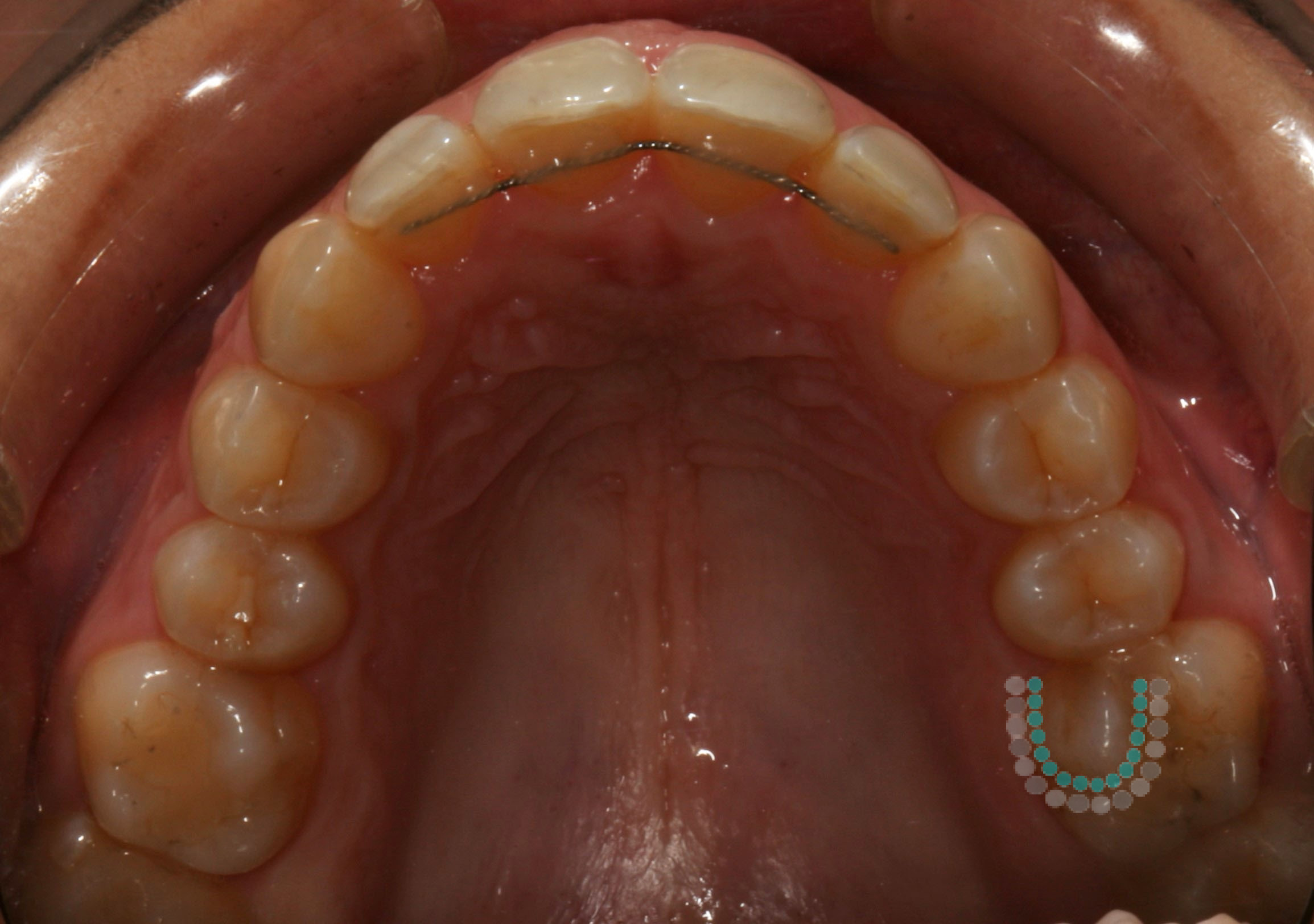 CM2.4 brilho cortada